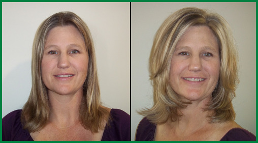 Scottsdale Hair Sytlist Before and After photo 1