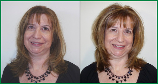 Scottsdale Hair Sytlist Before and After photo 2